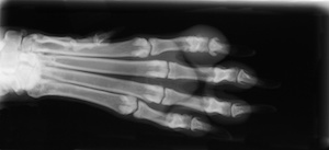 Digital X-Ray